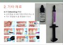 치과교정학 - 교정치료에 사용하는 기구와 취급방법 53페이지