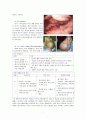 LC & varix bleeding 치료 및 간호 7페이지