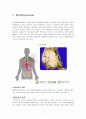 Thymoma(흉선종) 3페이지