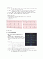 심전도의 이해 35페이지