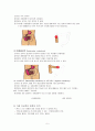 인공 장루와 장루 간호 6페이지