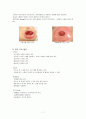 인공 장루와 장루 간호 8페이지