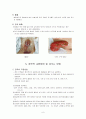인공 장루와 장루 간호 10페이지