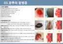 성인간호실습주제발표-장루간호pptx 11페이지