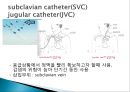 중심정맥관 종류와 관리 5페이지