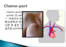 중심정맥관 종류와 관리 15페이지