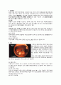 자궁선근종 간호 케이스스터디 2페이지