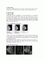 성인간호실습CASE [Breast cancer] A+받은 자료입니다!! 10페이지
