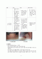 [간호학] 구강장애와 간호 (구내염 침샘장애 종양 외상) 4페이지