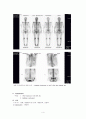 [침구과학] 교통사고로 인한 Lt chest pain 과 multiple contusion을 호소하는 환자 사례에 대한 고찰 5페이지