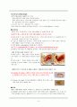 [질병고찰] 자연분만 (NSVD - Normal Spontaneous Vaginal Delivery) 8페이지