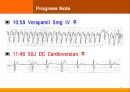 case발표심장(PSVT) 17페이지