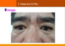 case발표 내과(SJS) 15페이지
