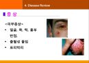 case발표 내과(SJS) 29페이지