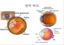 눈건강장애 4페이지
