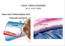 눈건강장애 11페이지