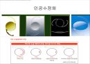 눈건강장애 14페이지