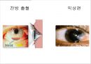 눈건강장애 20페이지