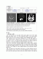[동서협진과 CASE] Drowsy mentality를 주소로하는 급성기 뇌경색 환자 1례 2페이지