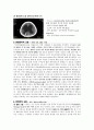 [동서협진과 CASE] Hydrocephalus로 대표되는 Sequelae of Intracerebral hemorrhage 환자 1례 2페이지