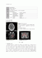 [동서협진과 CASE] Stupor mentality와 Quadriplegia를 주소로 하는 뇌경색 후유증 남환 1례 2페이지