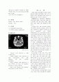 [동서협진과 CASE] Sputum을 호소하는 뇌경색 후유증 환자 1例 2페이지