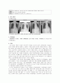 [동서협진과 CASE] 객담을 호소하는 뇌교경색 남환 1례 2페이지