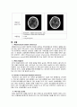 [동서협진과 CASE] 두개내출혈 후 VRE 환자 1례 2페이지
