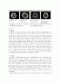 [동서협진과 CASE] 두개내출혈 후 수두증이 나타난 87세 여환 1례 2페이지