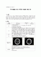 [동서협진과 CASE] 두개내출혈 이후 수두증이 병발한 여환 1례 1페이지