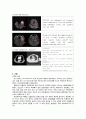 [동서협진과 CASE] 폐렴을 동반하는 뇌경색 환자 1례 2페이지