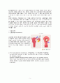 여성간호학 임상실습 자궁근종 케이스자궁근종 간호과정myoma uterus case study A+ 5페이지