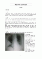 아동간호학 임상실습 폐렴 케이스폐렴 간호과정Pneumonia case study A+ 3페이지