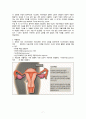 여성간호학 임상실습 자궁내막증 케이스자궁내막증 간호과정자궁내막증 간호진단 A+ 7페이지