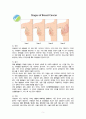 여성간호학 임상실습 유방암 케이스유방암 간호과정유방암 간호진단 A+ 5페이지