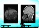 MRI(자기공명영상)의 소개 14페이지