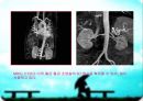 MRI(자기공명영상)의 소개 16페이지
