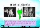 MRI(자기공명영상)의 소개 17페이지
