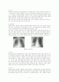 [아동간호학 실습] 폐렴 & 천식 사례 보고서 2페이지
