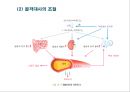 신경 및 골격계 질환 25페이지
