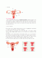 자궁근종(uterine myoma) 케이스 스터디 2페이지