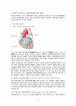 협심증 (angina pectoris) 수술실 케이스 문헌고찰 간호과정(간호진단 4개) 5페이지