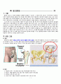 [A+] 성인간호학 실습 case study Fracture of base of neck of femur 대퇴골 경부 바닥의 골절 케이스 스터디 간호진단 8개 간호중재 3페이지