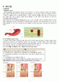 성인간호학 Stomach cancer(위암) 간호과정 case study 6페이지