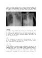 울혈성 심부전(congestive heart failure)케이스 레포트 4페이지