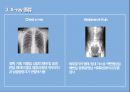 x-ray & bone scanppt 의 모든것이 있습니다 5페이지