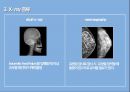 x-ray & bone scanppt 의 모든것이 있습니다 6페이지