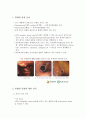 위궤양 출혈 3페이지