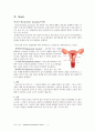 [모성]A+ uterine myoma 자궁근종(점막하근종) case study ,문헌고찰(추천) 4페이지