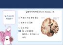 제누피그에 대한 모든것 ppt 발표자료 A++ - 치매유전자를 보유한 복제돼지, 제누피그.pptx 3페이지